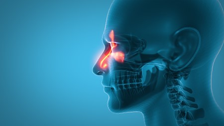 An xray of a person's head and neck with the sinuses highlighted